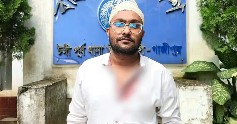আহত সাংবাদিক মারুফ হোসেন